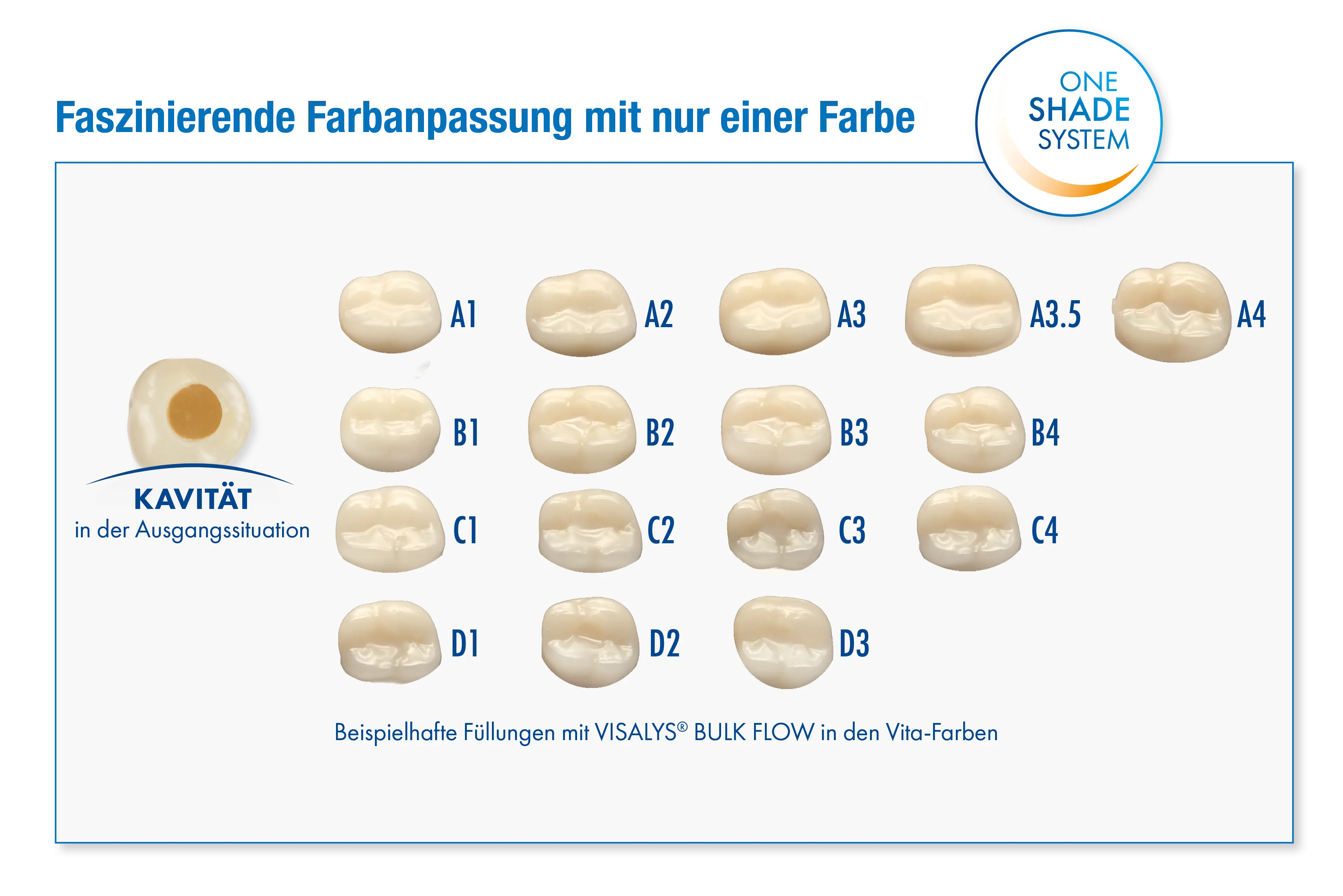 Vielfältige Farbanpassung mit One Shade System