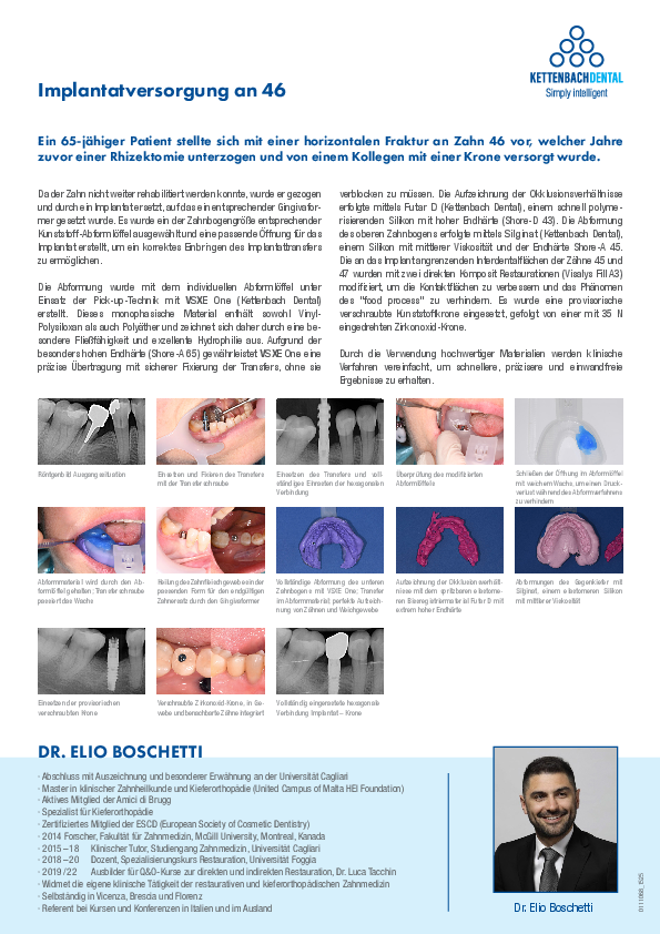 Implantatversorgung an Zahn 46