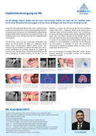 Implantatversorgung an Zahn 46