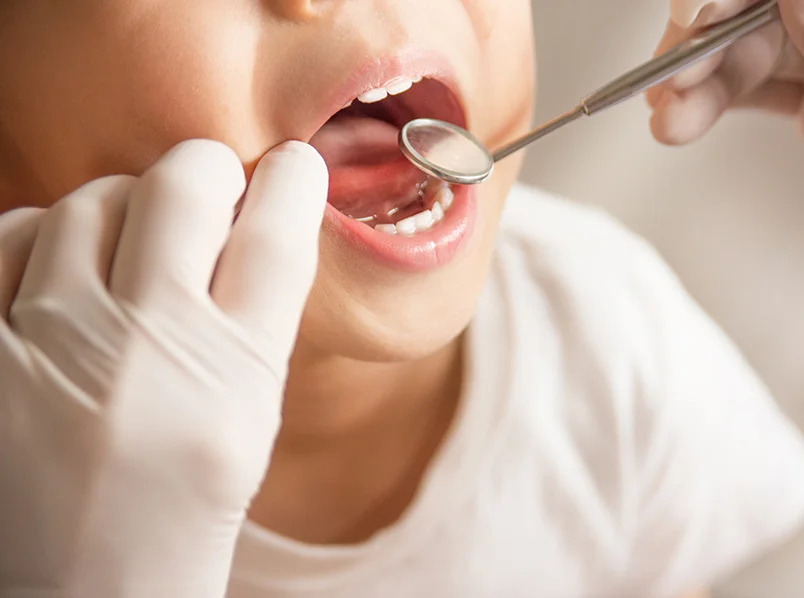 Examination of a child's teeth