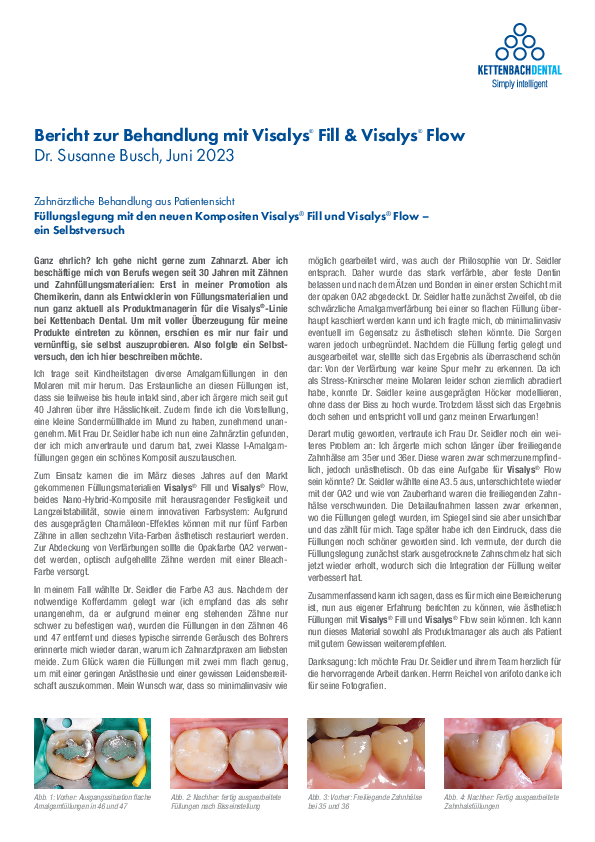 Bericht zur Behandlung mit Visalys® Fill & Visalys® Flow