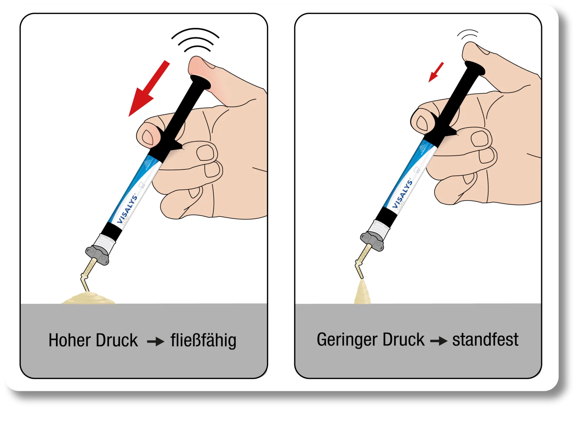 Hoher Applikationsdruck für Fließfähigkeit, geringer Applikationsruck für Standfestigkeit