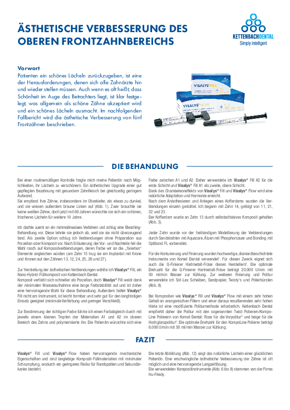Ästhetische Verbesserung des oberen Frontzahnbereichs