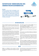 Ästhetische Verbesserung des oberen Frontzahnbereichs