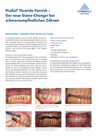 Der neue Game-Changer bei schmerzempfindlichen Zähnen