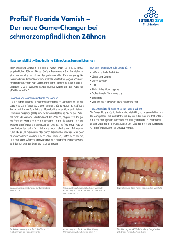 Der neue Game-Changer bei schmerzempfindlichen Zähnen