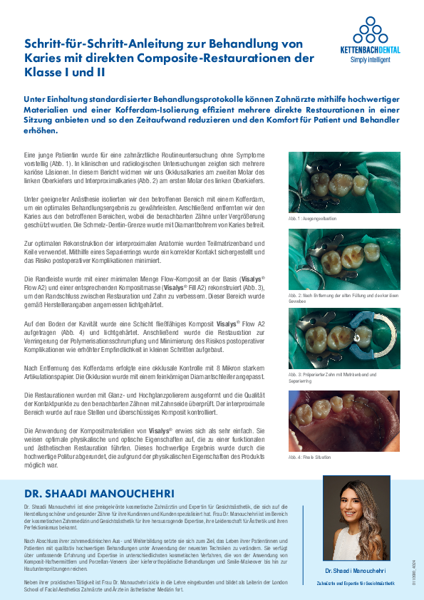 Schritt-für-Schritt-Anleitung zur Behandlung von Karies mit direkten Composite-Restaurationen der Klasse I und II