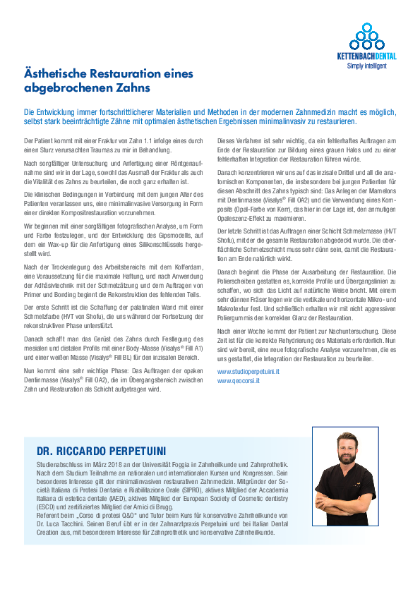 Ästhetische Restauration eines abgebrochenen Zahns