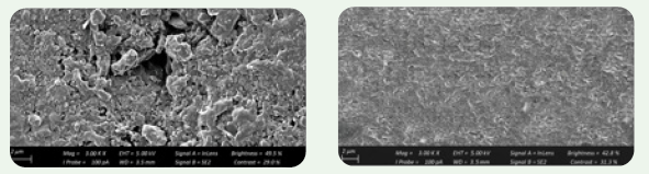 REM-Aufnahmen von VISALYS BIOCERAMIC (rechts) im Vergleich zu einem Konkurrenzprodukt (links). 